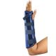 MGRM Forearm Fracture Brace (RS Brace)